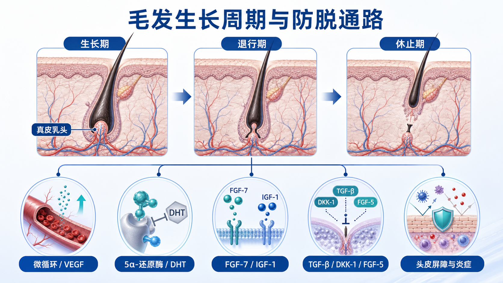 毛发生长周期、真皮乳头、微循环、DHT、生长因子和头皮炎症通路示意图